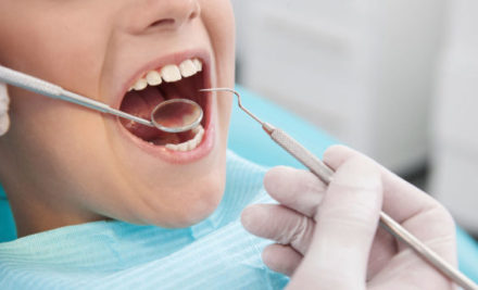 ¿Qué es un empaste dental y cómo se realiza?