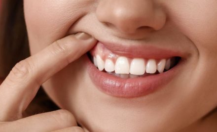 ¿Qué es la periodontitis? Causas y tratamiento