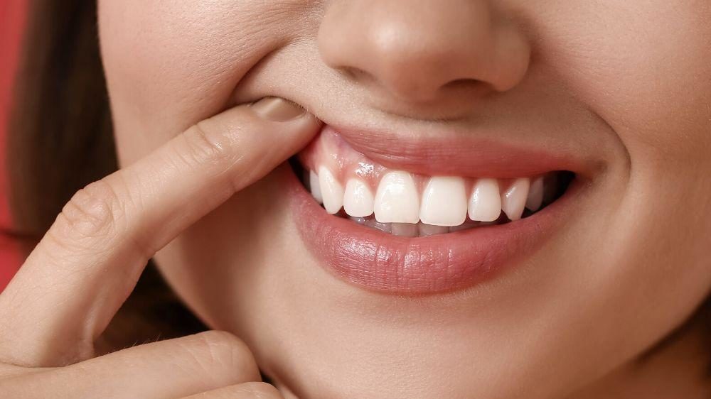 ¿Qué es la periodontitis? Causas y tratamiento