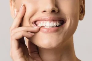 Manchas en los dientes: causas, tipos y cómo prevenirlas