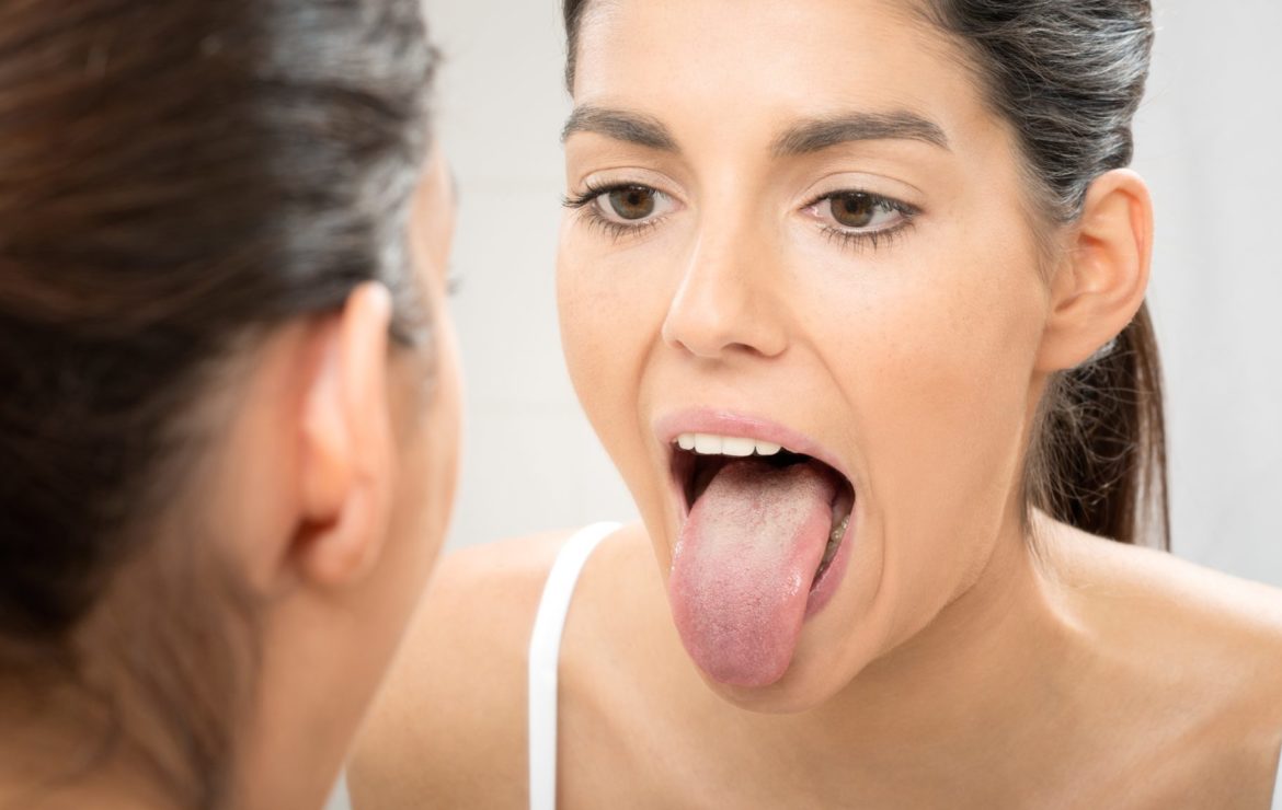 ¿Qué dice la lengua sobre nuestra salud bucodental?