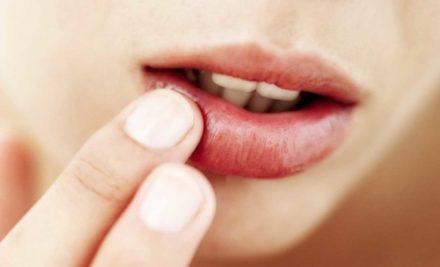 Llagas e inflamación en la boca: causas y tratamiento