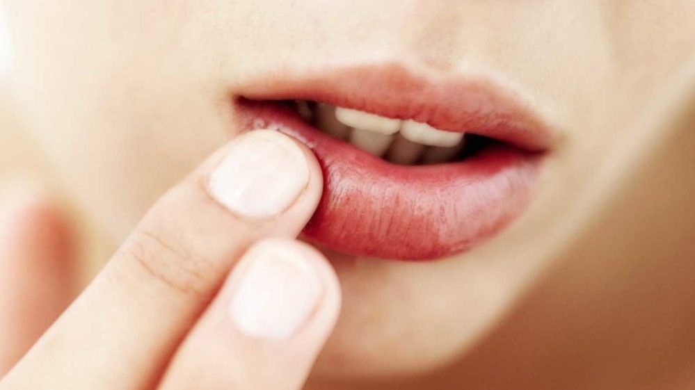 Llagas e inflamación en la boca: causas y tratamiento